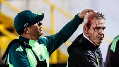  Dura agresión al entrenador de México: todos los detalles 